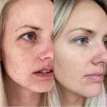 سرم الفا اربوتین اوردینری