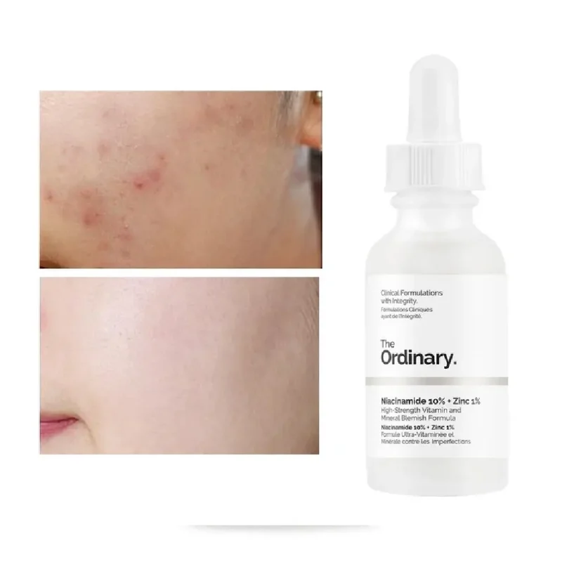 سرم نیاسینامید اوردینری